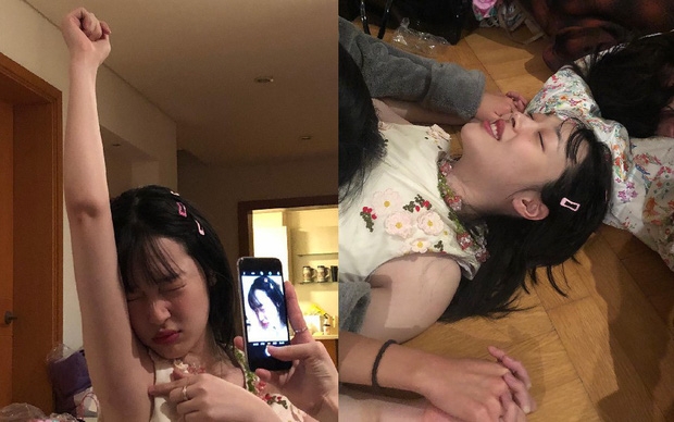 bieu hien bat thuong cua sulli truoc khi qua doi